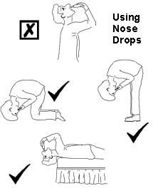 Nasal polyps: how to use nose drops