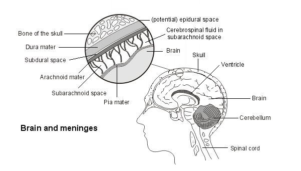 brain and meninges to explain idiopathic intracranial hypertension