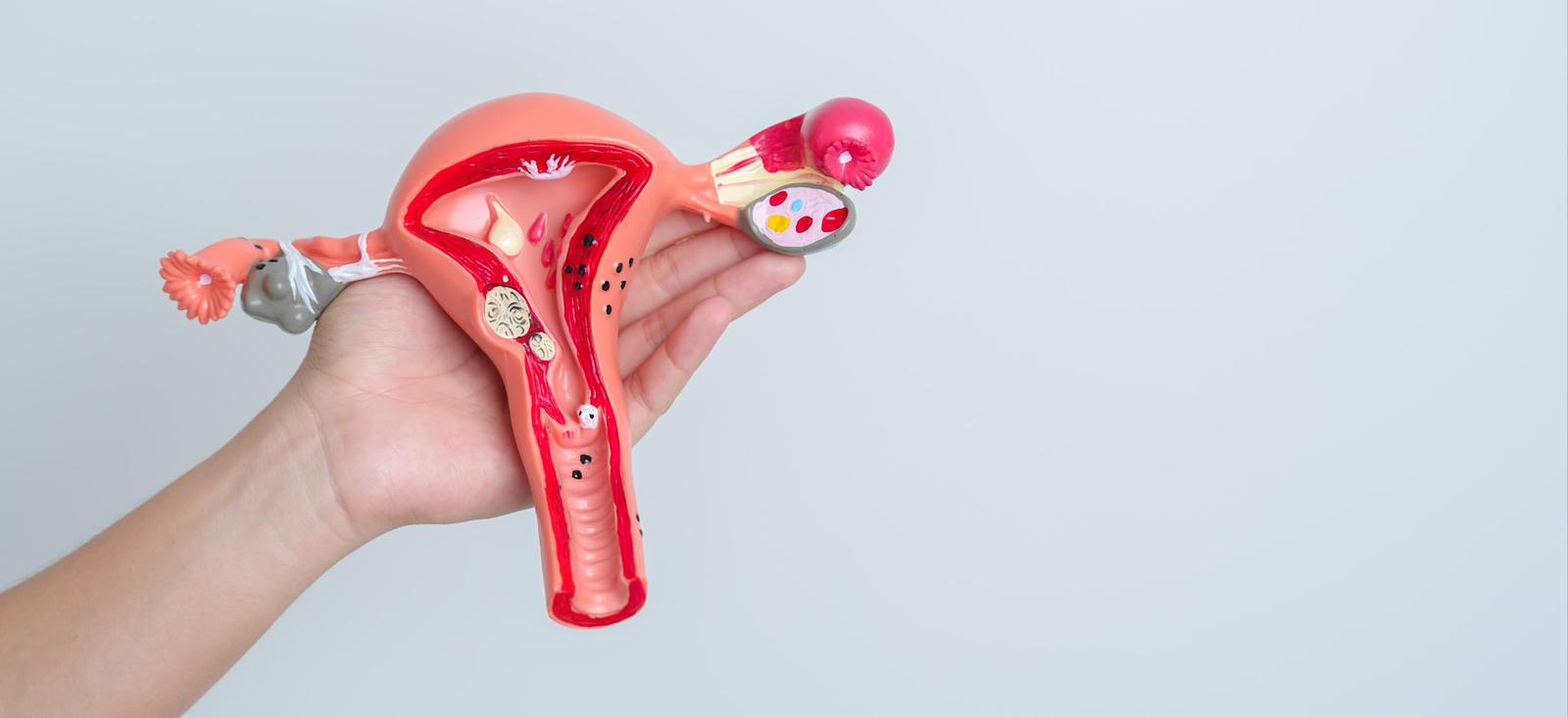 Hand holding anatomical model of female reproductive system showing uterus, fallopian tubes and ovaries against light background.