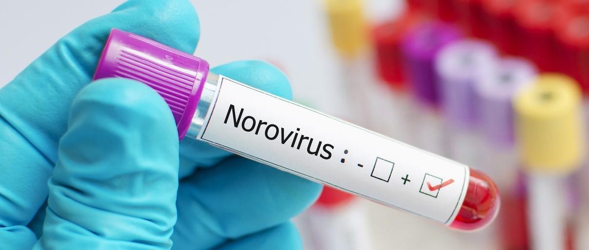 Norovirus - when to see a doctor