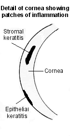 Corneal inflammation