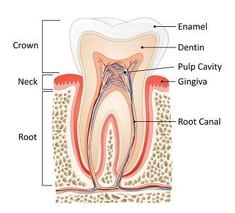 Root canal Toothpick image