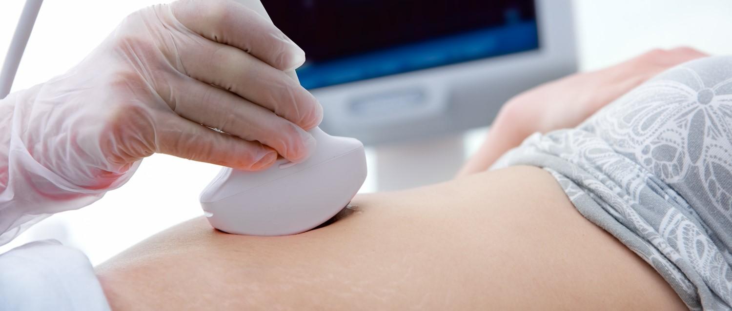 When to investigate a miscarriage