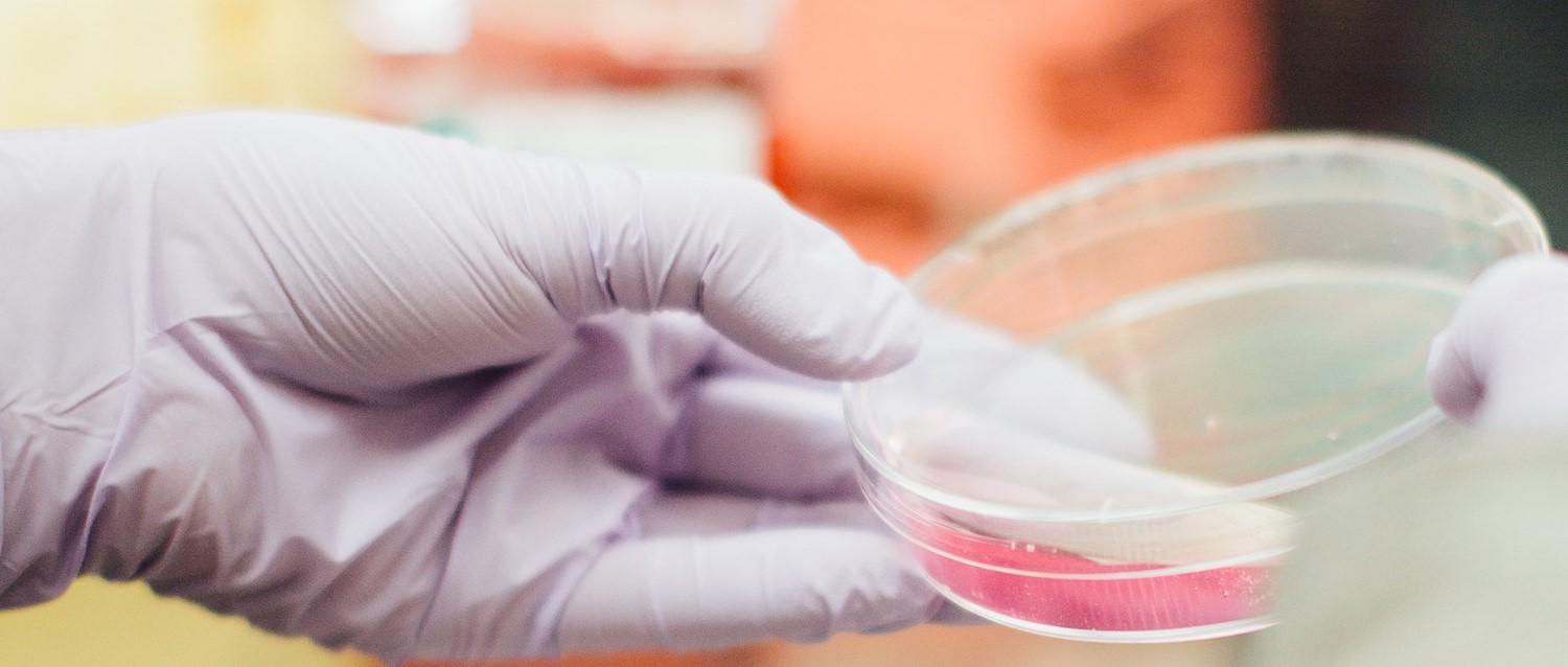 New blood test may detect aggressive prostate cancer